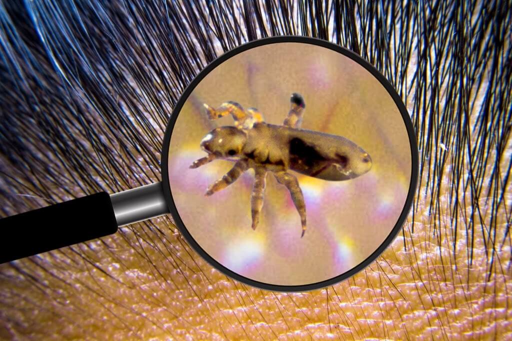 Does Hair Dye Kill Lice? How to Apply Hair Dye to Remove Lice Levo League